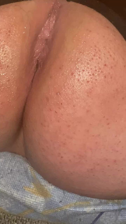 My butt after dildo.....