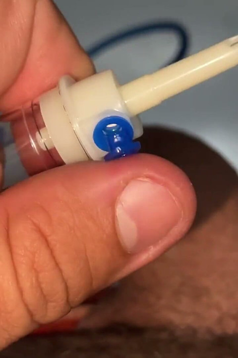 Sounding Extreme Sharp Probing in the Urethral Canal