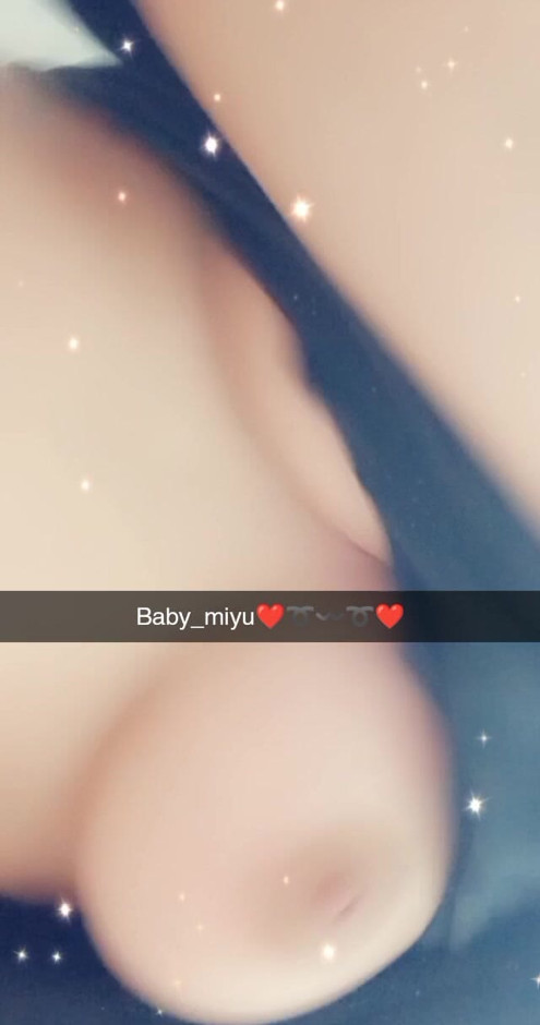 Breasts