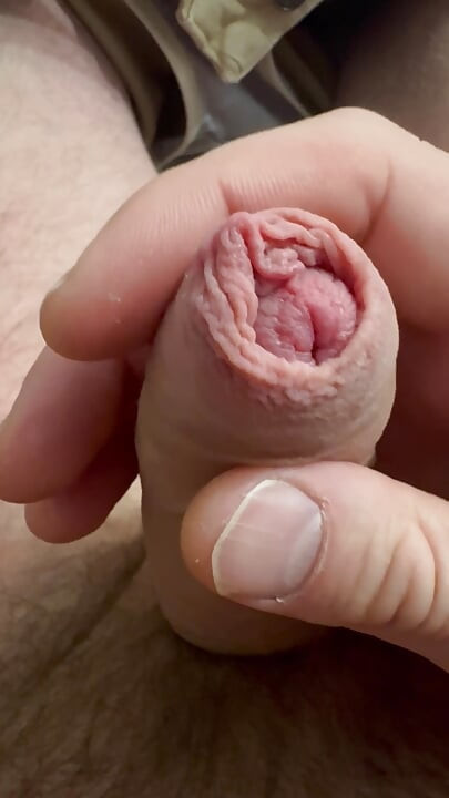 Foreskin. Shows the head of a dick.