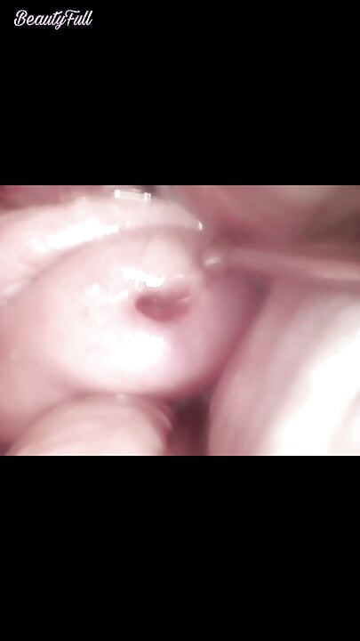 Cervix Ovulation Play With Endoscope And Voiceover