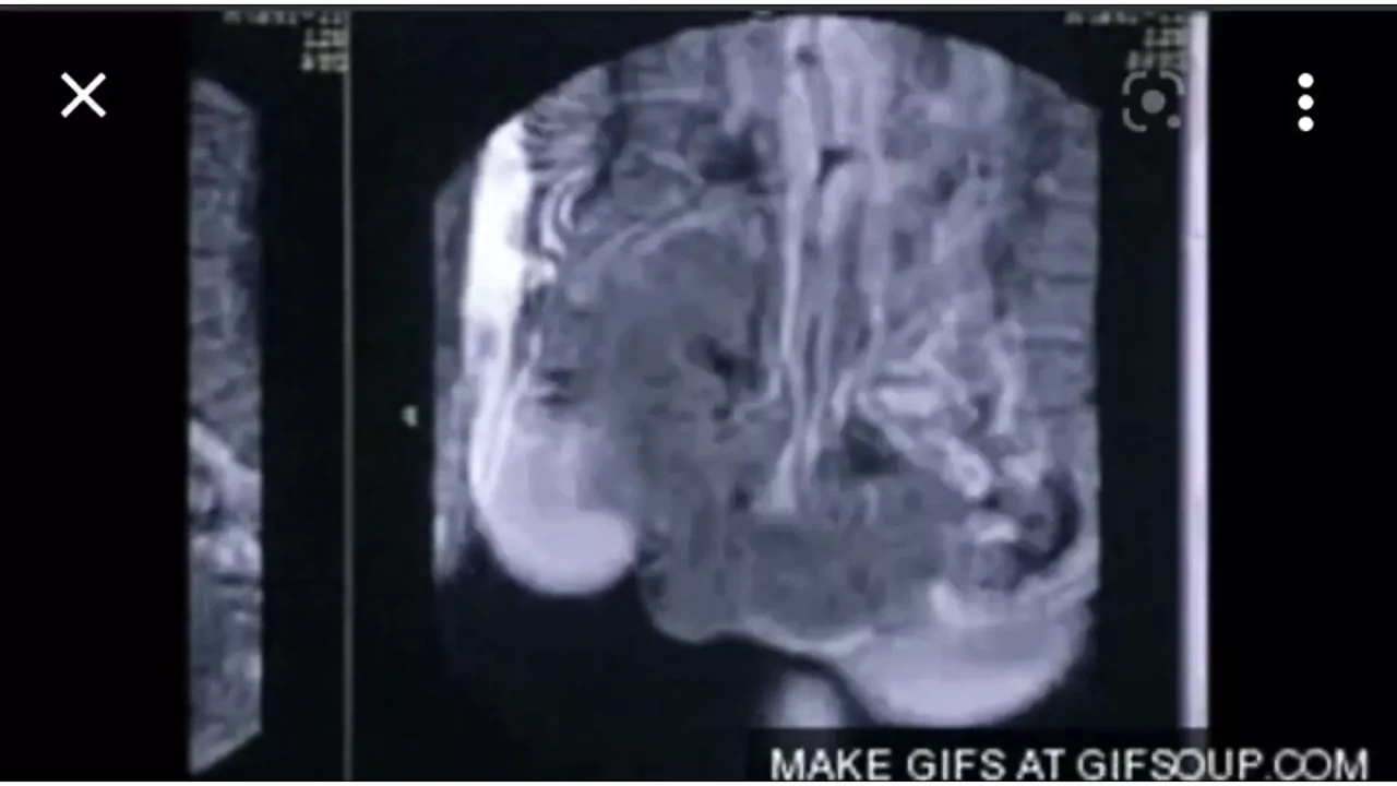 X-Ray – BlowJob