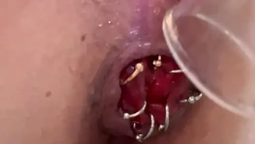 Piercing ile rektum hafif emme