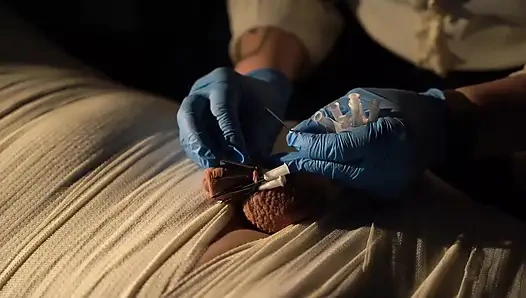 Tıbbi oyun eğlencesi, mumyalama, iğne cbt ve elektro