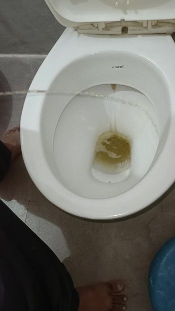 L’urine du matin pour tout le monde