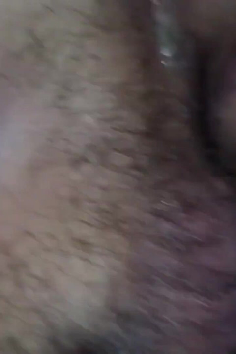 Destroying the Asshole on the Dick