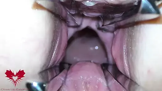 The mistress' cunt is opened with a hole expander so that you can study her cervix.