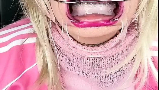 There's cum on my braces headgear...