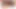 BOBSTGIRLS: A Total Eclipse of The Heart