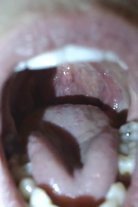 Super Closeup Yawning and Full View