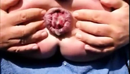 Object Anal Insertion - Anus Dilation