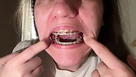 Облизывать брекеты языком