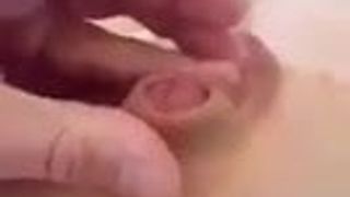 Kleinste penis ter wereld