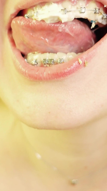 Key moment from "eating in braces - vore and food fetish - close up video"