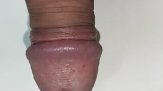 Dilator