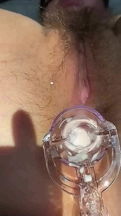 Zapanjujući trenutak iz "UBACUJU ANALNO SPEKULUM U MOJU DLAKAVU ANALNU RUPU I JEBU ME U GUZICU. MOJ ANAL POSTAJE"
