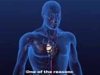 Herzinfarkt-Symptom