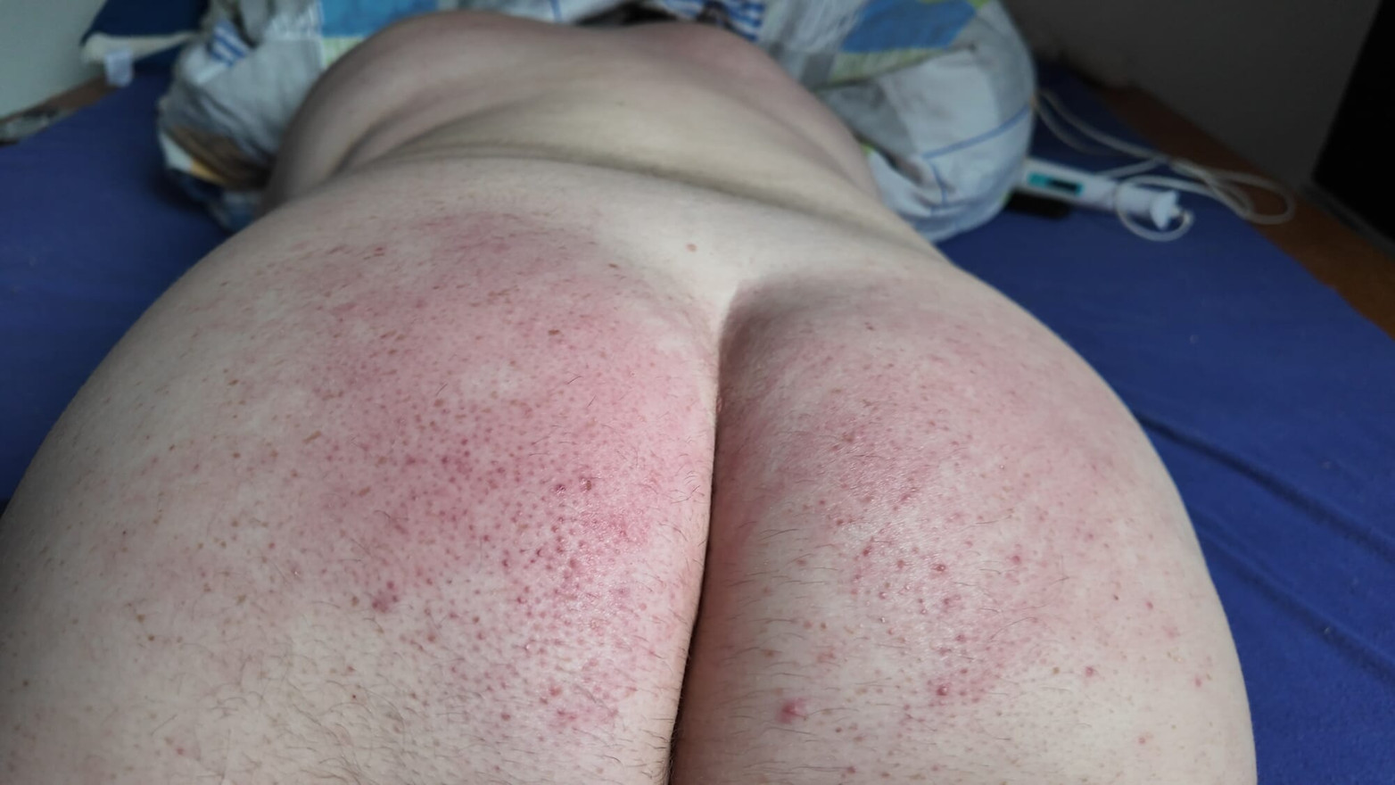 Getting a slap on the ass