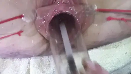 11 Weit Gespreizte Muschi Nahaufnahme Ficken Mit Lampe 1000 Watt