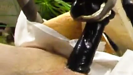 Becerdin tarafından yapay penis