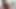 Lizzy Yum SD August 2025 Dilating #4