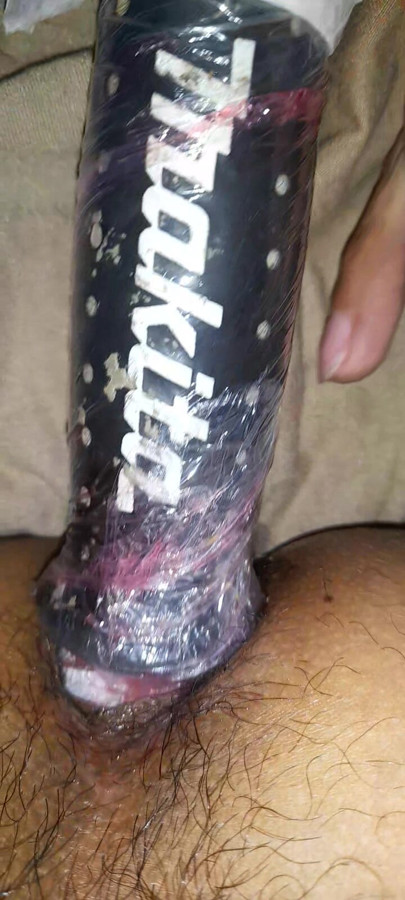 My ass