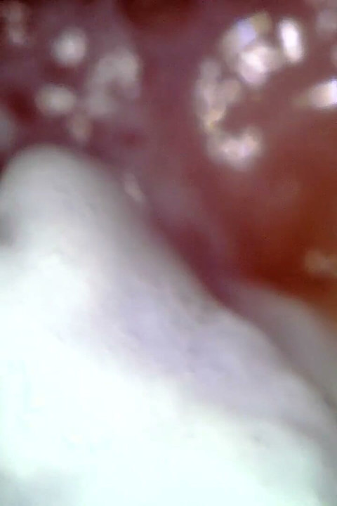 Medical Endoscope Oral Exam: Gummy Chewing, Extreme Teeth & Tongue Macro