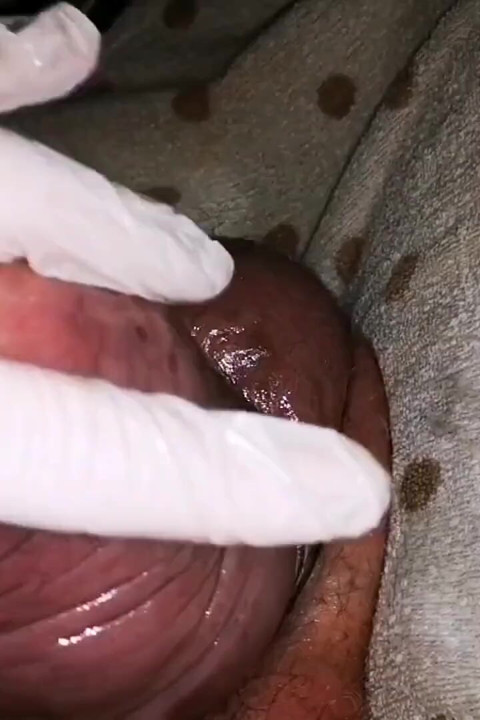 Dedilhado e Bombeamento para
