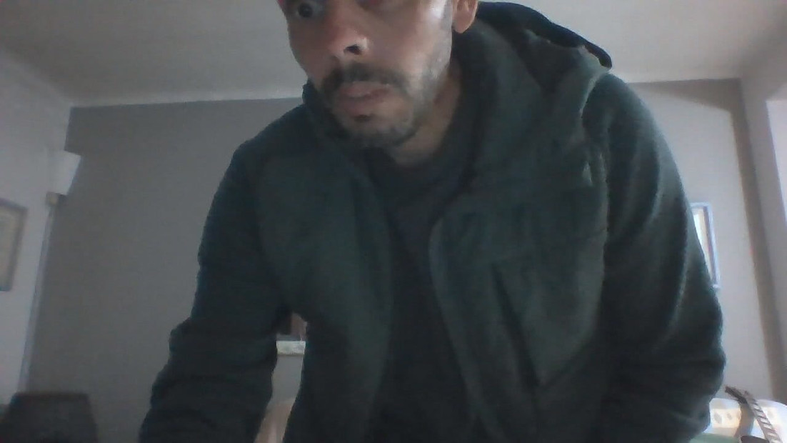 Moja prekrasna guza