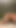 Anal