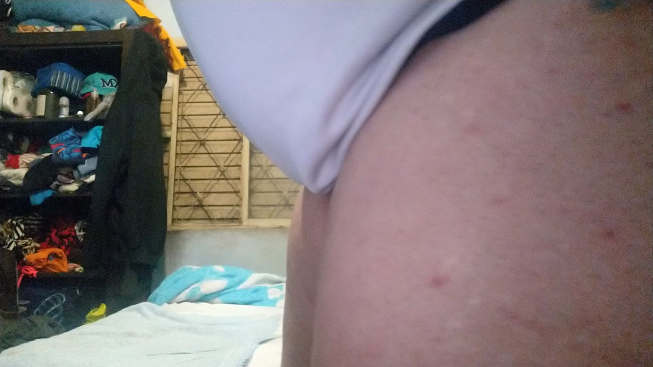 Treinamento anal
