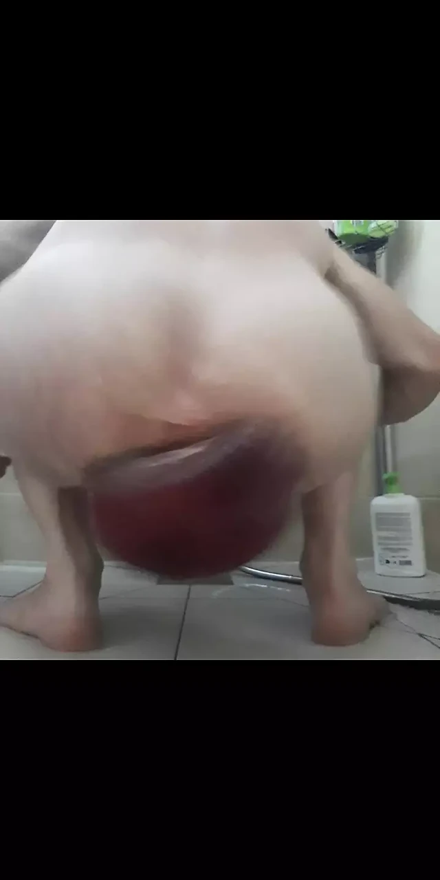 Little return prolapse