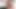 マミーズ・ボーイ - 5人の欲求不満な看護師たちの乱交 ラッキーティーンボーイ
