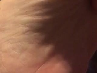 Wife's feet veins