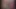 Bg Analno