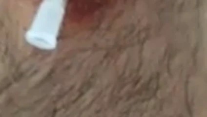 Ab durch die Brust! Aua! 5