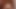 Extreme, anal gaping with a huge dildo