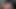 26 cm 5 cm anal eyersiz gay cum bbc