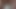 LizzyYum VR February 2024 I.C.E. ANAL Post Op Orgasm Pussy anal masturbation teasing