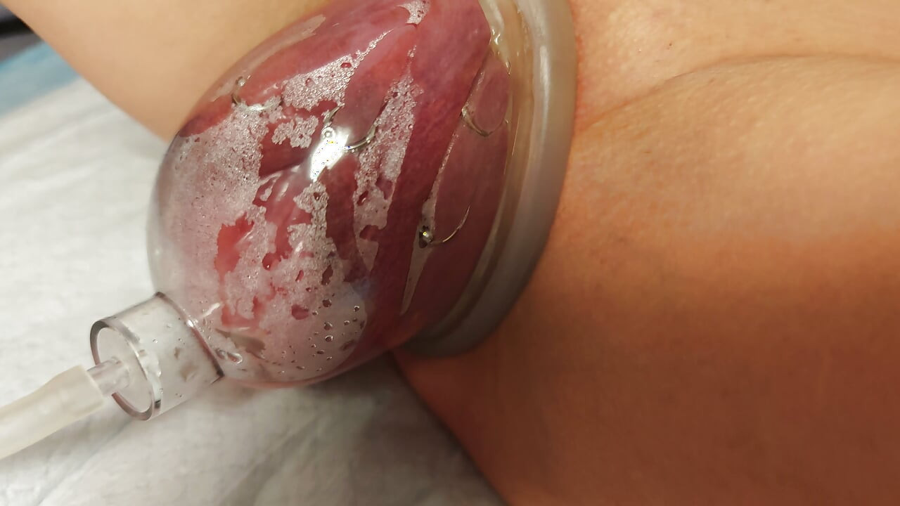 Extremely pumped pussy