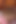 ショートヘアの美女たち、連続した10回の熱い出会い - シーン11