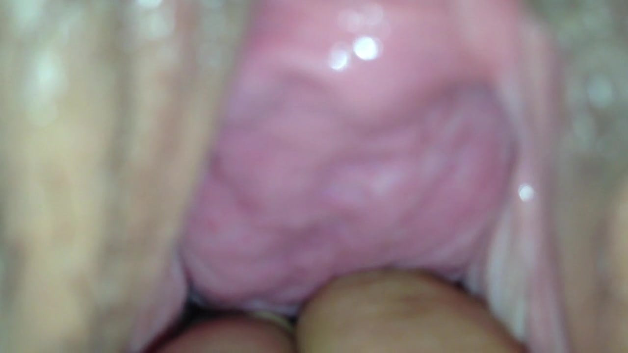 cervix