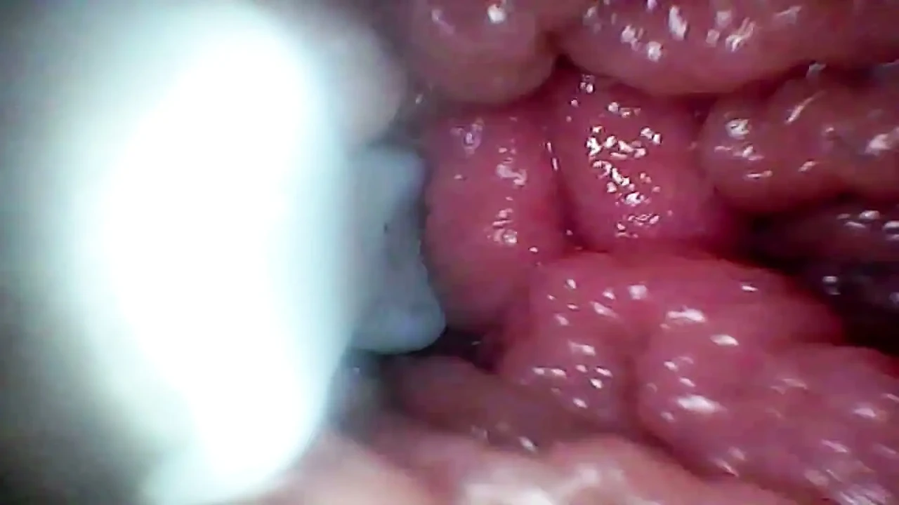 Endoscope Camera Records My Wife's G Spot. Educational Video Close up