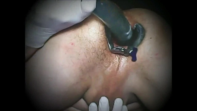 My Gape Pt 2