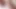 Teen Adriana - Close-up Pussy, Next Day