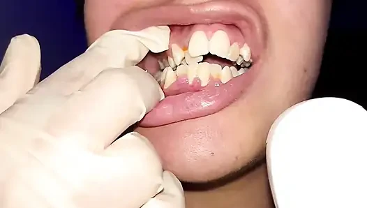 Versuche, Zahnseide zu verwenden (Nahaufnahme)