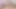 4K горячие медсестры применяют шоковое лечение для раненых пациентов