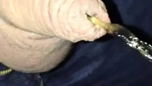 sünnet derisi çiş