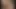 Целлюлит Fister