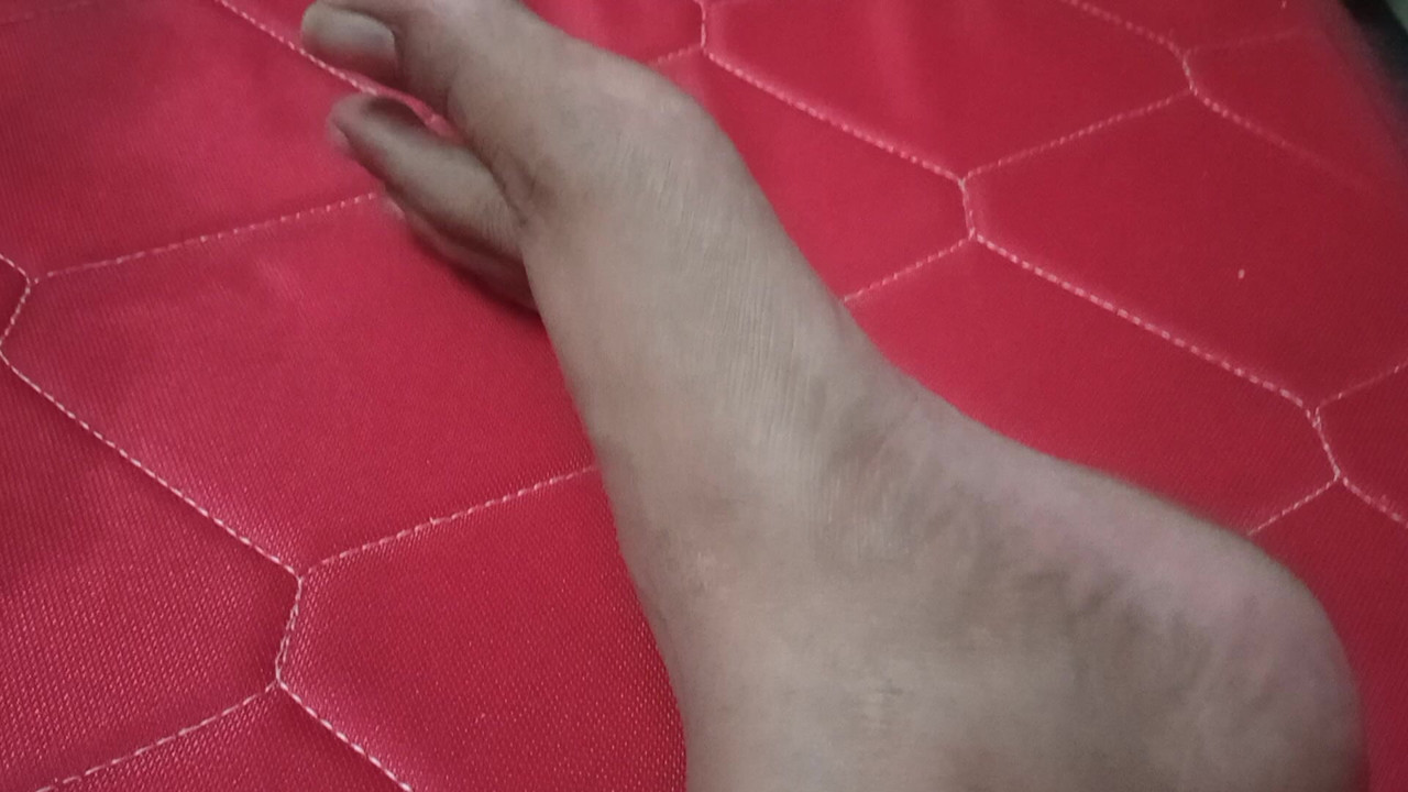 Aunty leg